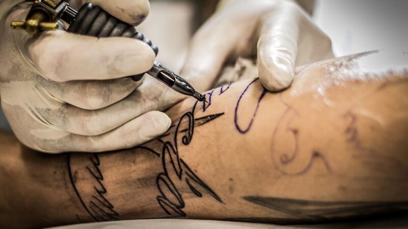 Rimozione tatuaggi: tecniche, costi e come toglierli